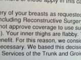 Denial letter for part of my reconstruction for mastectomy from Anthem Blue Cross. They have never seen my thighs. Rest assured, as a former marathoner and chemo patient they aren't flabby. What asshole thought it was acceptable to write this???