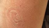 Detailed imprint of my boyfriend's ear on my leg.