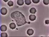 White blood cell chases a bacterium to engulf it