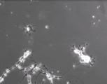 This is time lapse footage of neurons making new connection to other neurons, This is what your thoughts look like