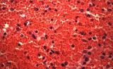 This is what our blood looks like under high magnification!